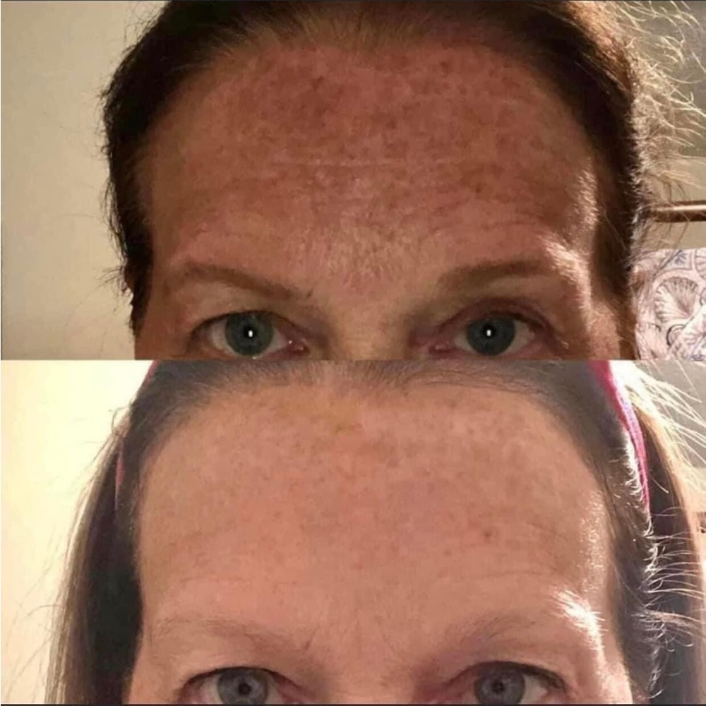 Vitamin C facial wash . Get rid of dark spots with purchase